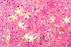 Jolifin Snowflake Glitter - pink