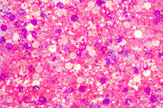 Jolifin Hexagon Glittermix - neon-pink